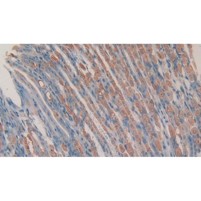 Chemerin (CHEM) Mouse Polyclonal Antibody
