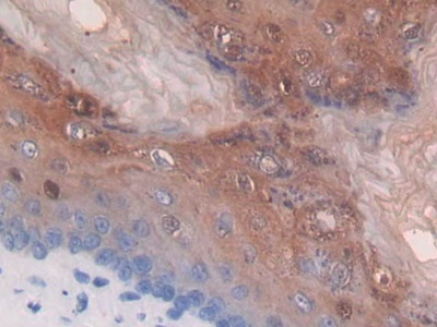 Thymidine Phosphorylase (TP) Mouse Polyclonal Antibody