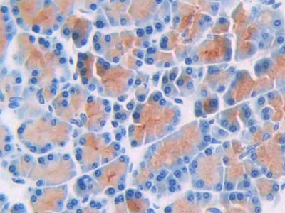 Thymidine Phosphorylase (TP) Rat Polyclonal Antibody