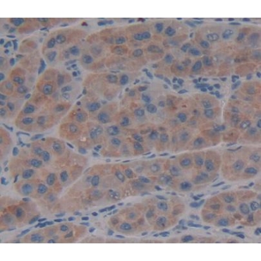 Von Willebrand Factor Cleaving Protease (vWFCP) Human Polyclonal Antibody