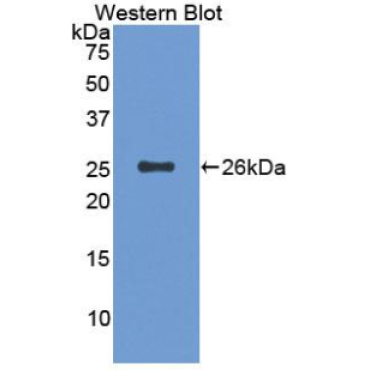 Cluster Of Differentiation 6 (CD6) Human Polyclonal Antibody