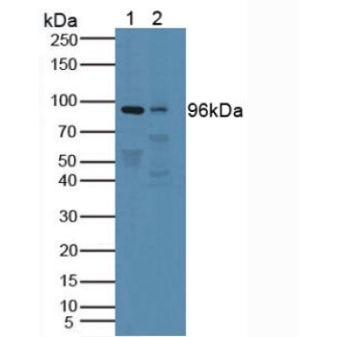 Protein Tyrosine Phosphatase Receptor Type N (PTPRN) Human Polyclonal Antibody