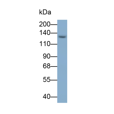 Procollagen I N-Terminal Propeptide (PINP) Human Polyclonal Antibody