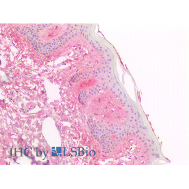 Procollagen I N-Terminal Propeptide (PINP) Human Polyclonal Antibody