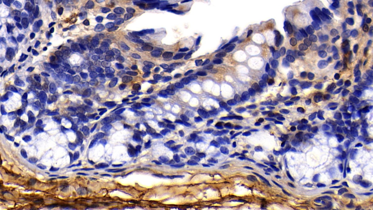 Procollagen I N-Terminal Propeptide (PINP) Rat Polyclonal Antibody