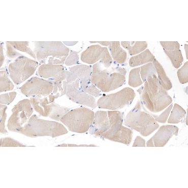Pyruvate Dehydrogenase Kinase 4 (PDK4) Human Polyclonal Antibody