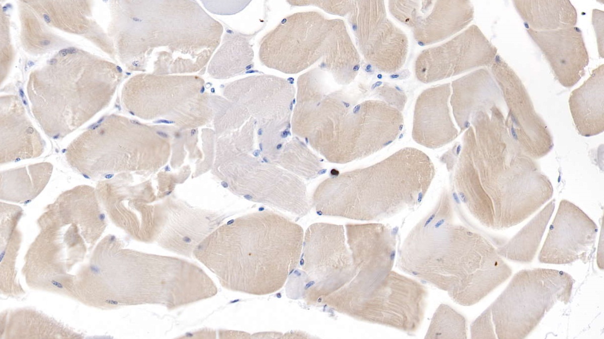Pyruvate Dehydrogenase Kinase 4 (PDK4) Human Polyclonal Antibody