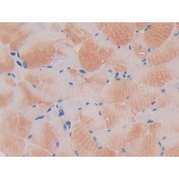 Pyruvate Dehydrogenase Kinase 4 (PDK4) Mouse Polyclonal Antibody