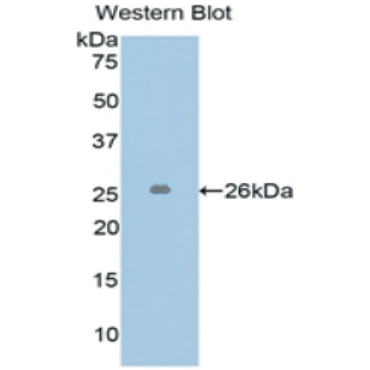L1-Cell Adhesion Molecule (L1CAM) Human Polyclonal Antibody