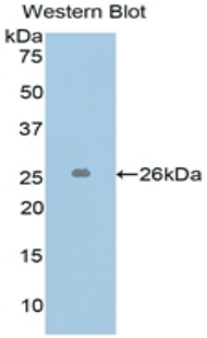 L1-Cell Adhesion Molecule (L1CAM) Human Polyclonal Antibody