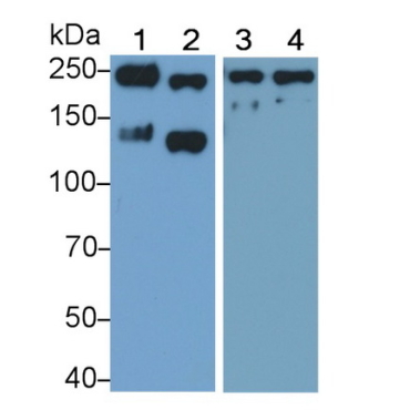 L1-Cell Adhesion Molecule (L1CAM) Human Polyclonal Antibody