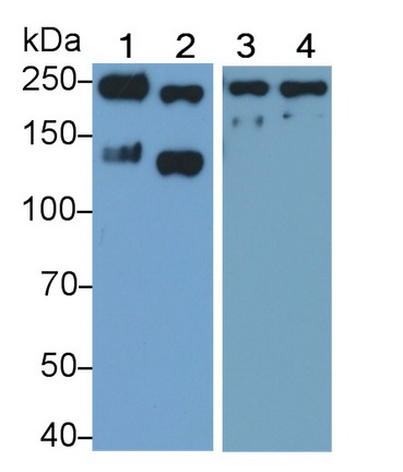 L1-Cell Adhesion Molecule (L1CAM) Human Polyclonal Antibody