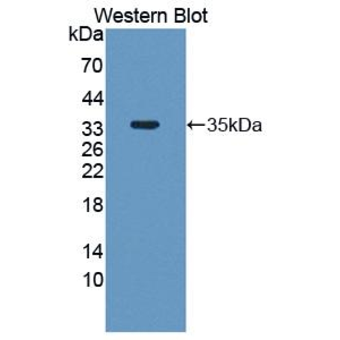 ATP Binding Cassette Transporter G2 (ABCG2) Human Polyclonal Antibody