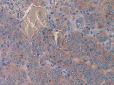 Procollagen III C-Terminal Propeptide (PIIICP) Rat Polyclonal Antibody
