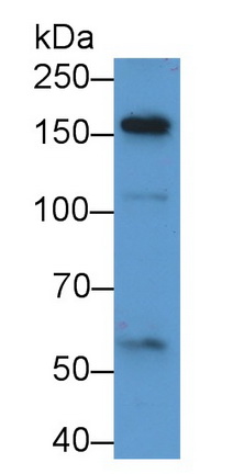 Alpha-2-Macroglobulin Like Protein 1 (a2ML1) Human Polyclonal Antibody