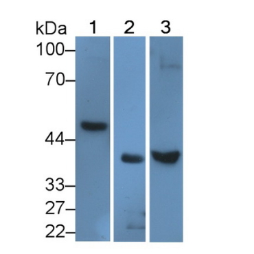Activin A Receptor Type I (ACVR1) Human Polyclonal Antibody