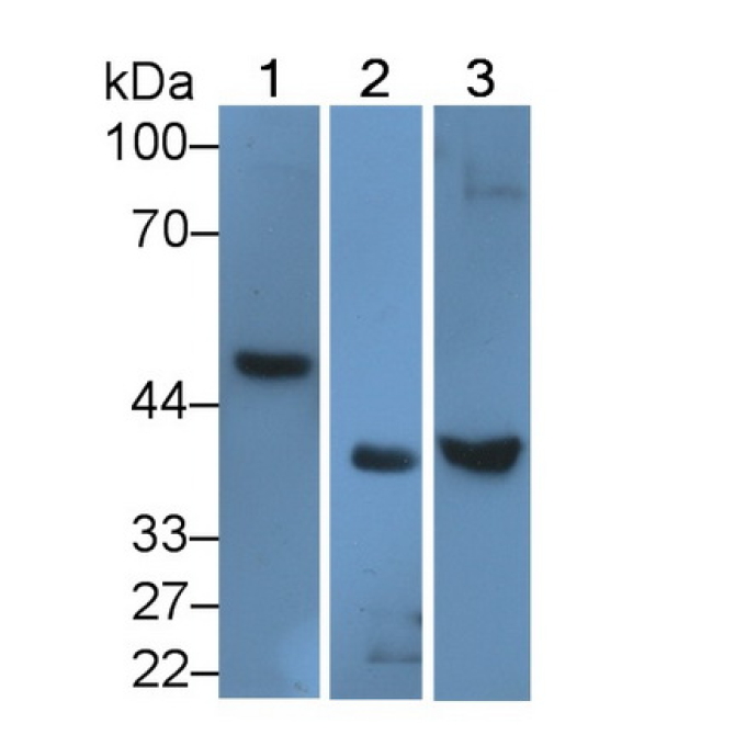 Activin A Receptor Type I (ACVR1) Human Polyclonal Antibody