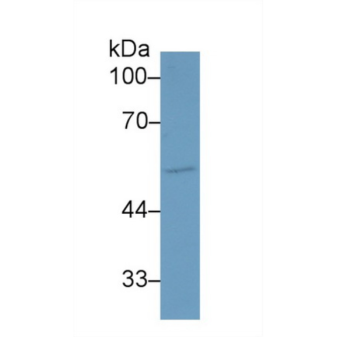 Activin A Receptor Type I (ACVR1) Human Polyclonal Antibody
