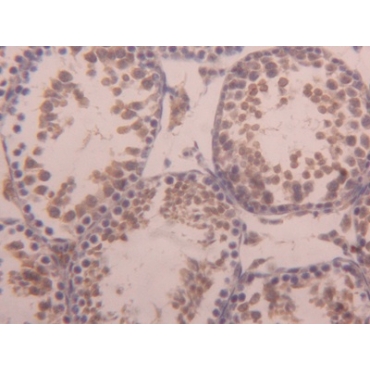 Activin A Receptor Type I (ACVR1) Mouse Polyclonal Antibody