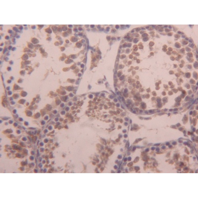 Activin A Receptor Type I (ACVR1) Mouse Polyclonal Antibody