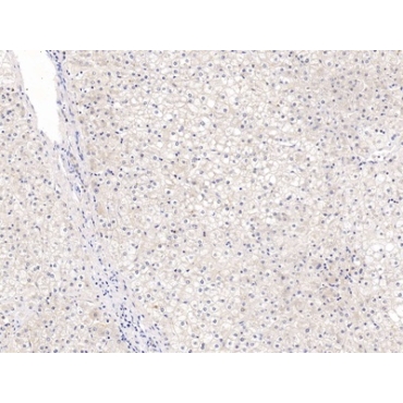 Glypican 3 (GPC3) Human Polyclonal Antibody