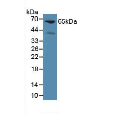 Glypican 3 (GPC3) Mouse Polyclonal Antibody