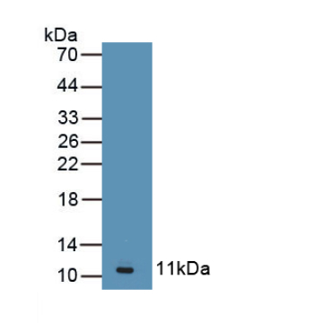 Angiotensin II Receptor 2 (AGTR2) Human Polyclonal Antibody