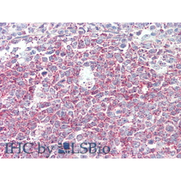 Discoidin Domain Containing Receptor 2 (DDR2) Human Polyclonal Antibody