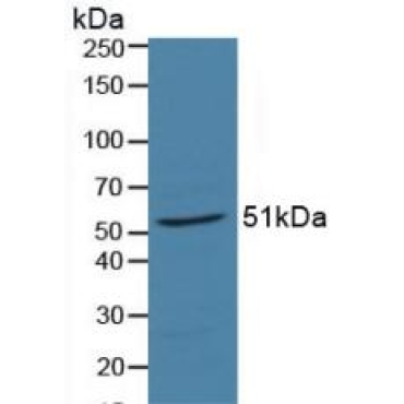 Retinoic Acid Receptor Alpha (RARa) Human Polyclonal Antibody