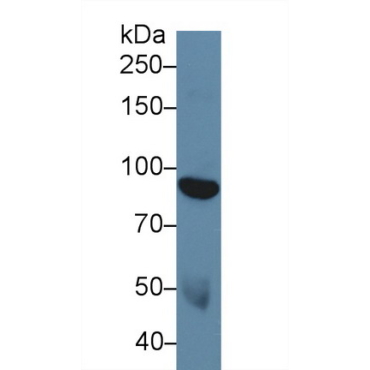 Discoidin Domain Receptor Family, Member 1 (DDR1) Human Polyclonal Antibody