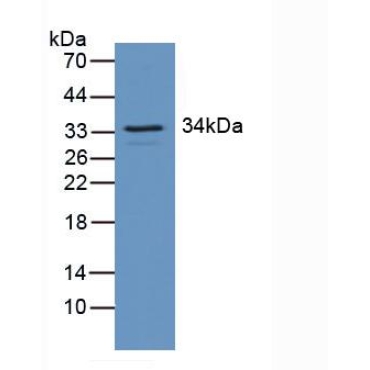 Regulator Of G Protein Signaling 4 (RGS4) Human Polyclonal Antibody