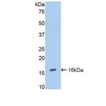 Endoglin (ENG) Human Polyclonal Antibody