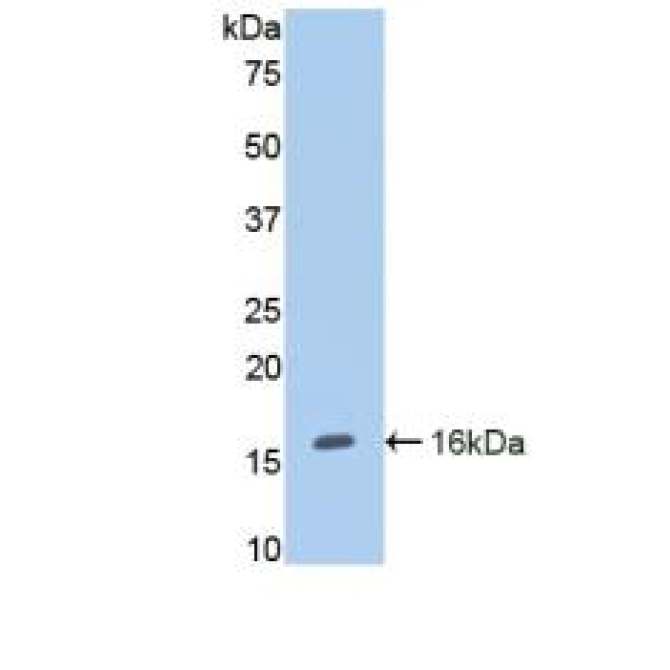 Endoglin (ENG) Human Polyclonal Antibody