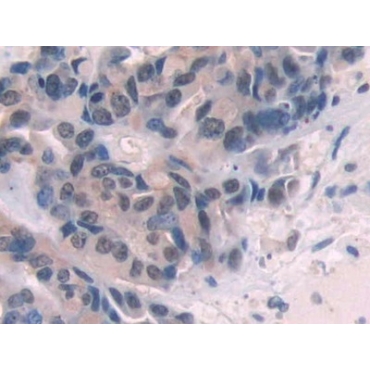 Endoglin (ENG) Human Polyclonal Antibody