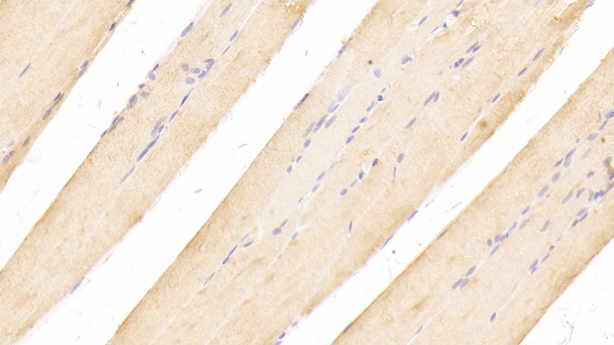 Cholinergic Receptor, Nicotinic, Alpha 1 (CHRNa1) Rat Polyclonal Antibody