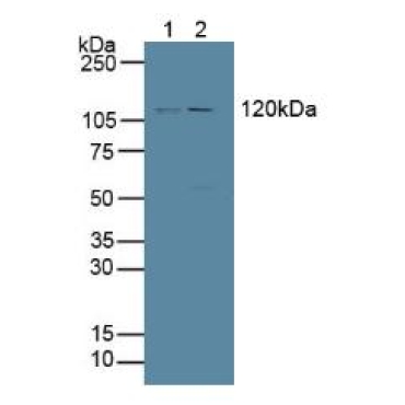 Protein Tyrosine Phosphatase Receptor Type H (PTPRH) Human Polyclonal Antibody