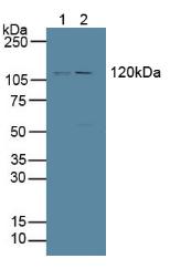 Protein Tyrosine Phosphatase Receptor Type H (PTPRH) Human Polyclonal Antibody