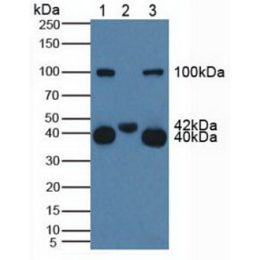 Cluster Of Differentiation 161 (CD161) Human Polyclonal Antibody