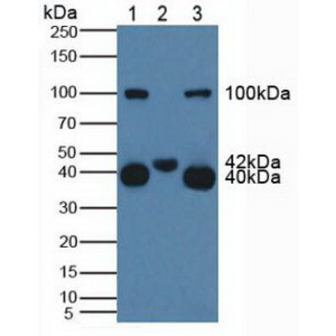 Cluster Of Differentiation 161 (CD161) Human Polyclonal Antibody