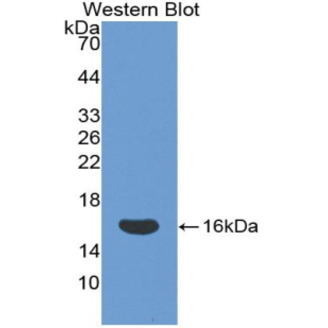 Cluster Of Differentiation 160 (CD160) Human Polyclonal Antibody
