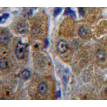 Acid Phosphatase 1 (ACP1) Human Polyclonal Antibody