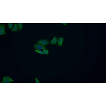 Acid Phosphatase 1 (ACP1) Human Polyclonal Antibody
