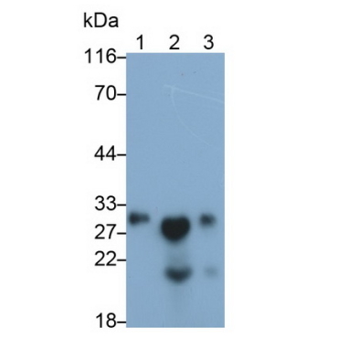Protein Zero, Myelin (MPZ) Human Polyclonal Antibody
