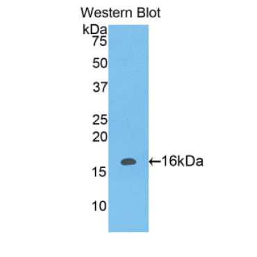 Leukocyte Associated Immunoglobulin Like Receptor 2 (LAIR2) Human Polyclonal Antibody