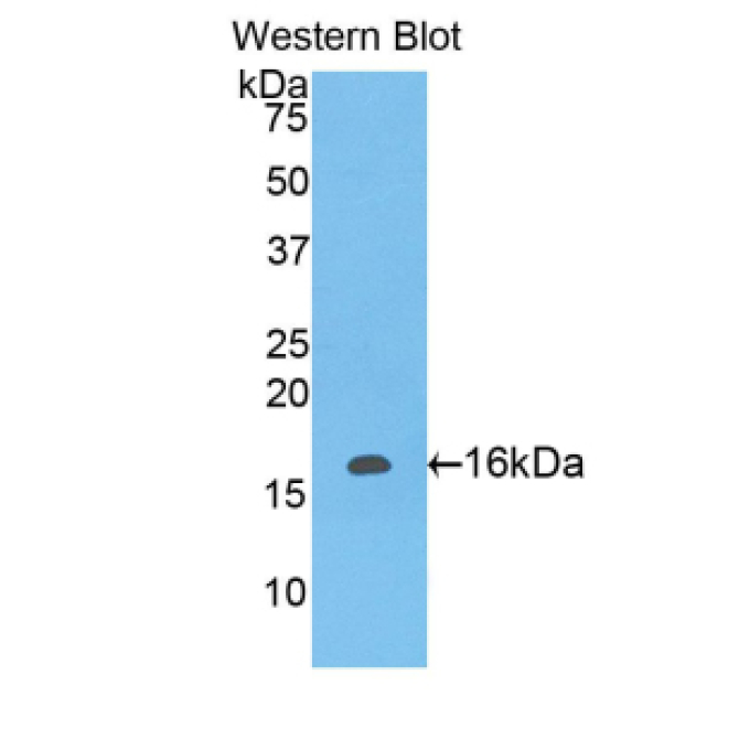 Leukocyte Associated Immunoglobulin Like Receptor 2 (LAIR2) Human Polyclonal Antibody
