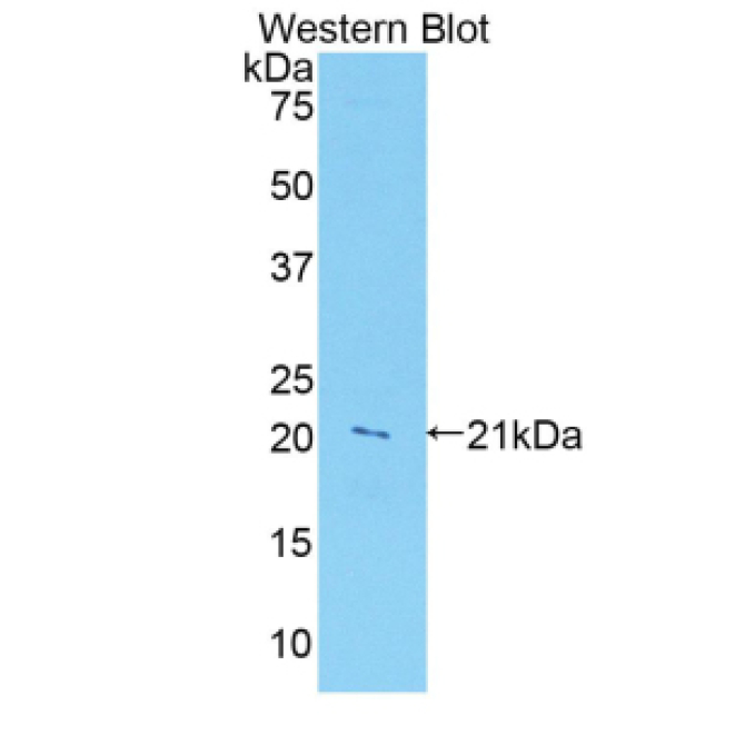 Leukocyte Associated Immunoglobulin Like Receptor 1 (LAIR1) Human Polyclonal Antibody