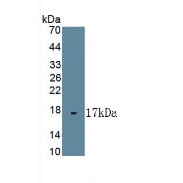 High Density Lipoprotein (HDL) Human Polyclonal Antibody