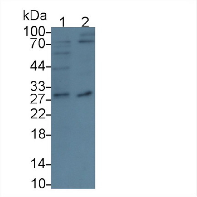 Cluster Of Differentiation 320 (CD320) Human Polyclonal Antibody