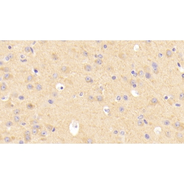 Low Density Lipoprotein Receptor (LDLR) Mouse Polyclonal Antibody