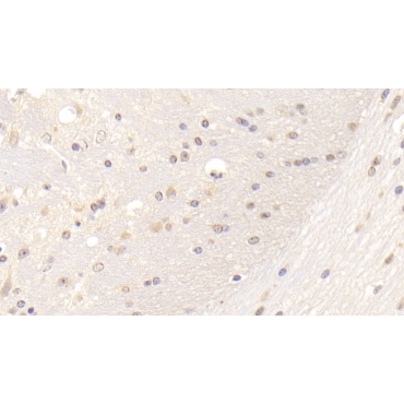 Low Density Lipoprotein Receptor (LDLR) Mouse Polyclonal Antibody